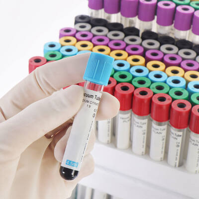 acheter Vacuum EDTA Blood Tubes for Complete Blood Count (CBC) – High Quality, Secure Seal fabrication en ligne
